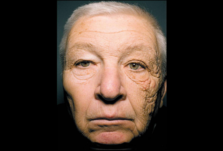 skin damaged driving skin damaged driving