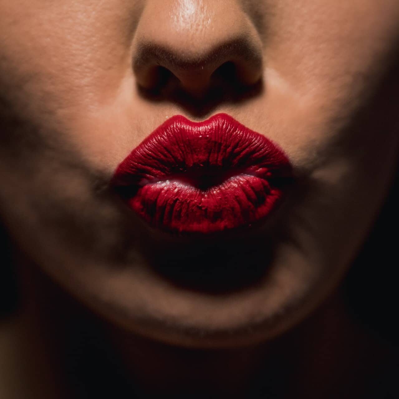 Botox Lip Flip Botox Lip Flip