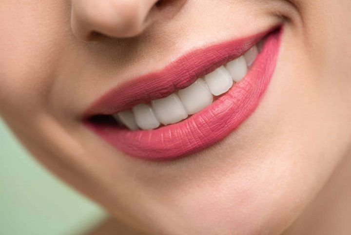 Lip Filler Aftercare Lip Filler Aftercare