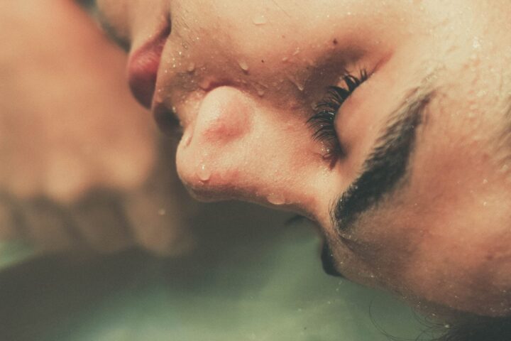 Skin Purging Skin Purging
