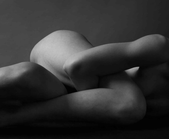 Liposuction Liposuction