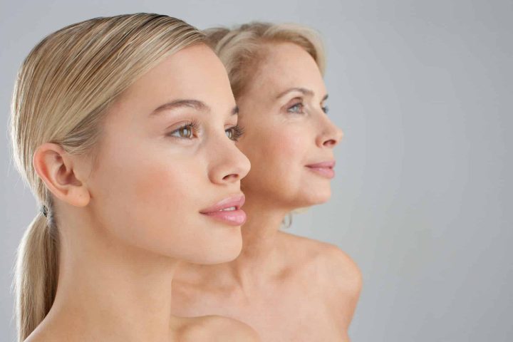 Upper Blepharoplasty Upper Blepharoplasty