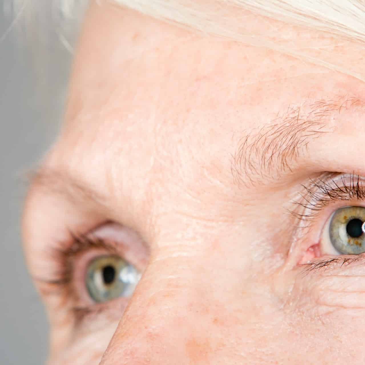 under-eye treatment under-eye