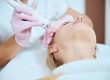 Laser Treatments
